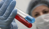 Nga thử nghiệm ba loại vaccine ngừa HIV