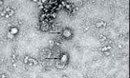 Một nghiên cứu của các nhà khoa học: Virus nCoV có thể ủ bệnh 24 ngày