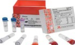 Bộ kit xét nghiệm virus SARS-CoV-2 của Hàn Quốc cho kết quả sau 20 phút