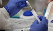 Israel phân lập thành công kháng thể virus SARS-CoV-2