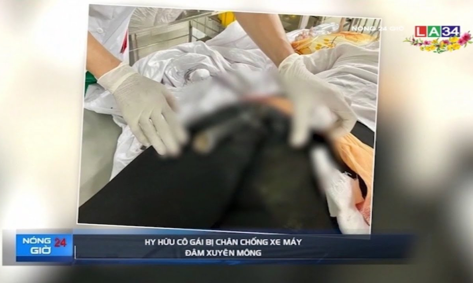 Hy hữu: Cô gái bị chân chống xe máy đâm xuyên mông