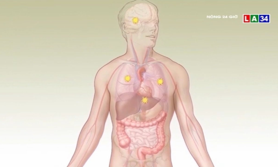 Cẩn trọng: Ung thư vú ở nam giới nguy hiểm hơn phụ nữ