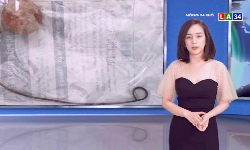 Cụ bà quên ống dẫn nước tiểu 9 năm trong cơ thể, sỏi bám to bằng quả trứng