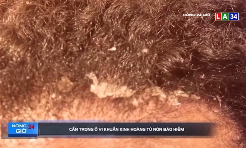 Cẩn trọng ổ vi khuẩn kinh hoàng từ nón bảo hiểm