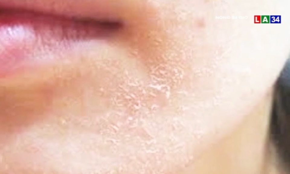 Rước họa vì mỹ phẩm nhau thai động vật bán tràn lan trên mạng xã hội