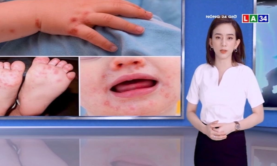 Long An: Xuất hiện các ca tay chân miệng dưới 4 tháng tuổi