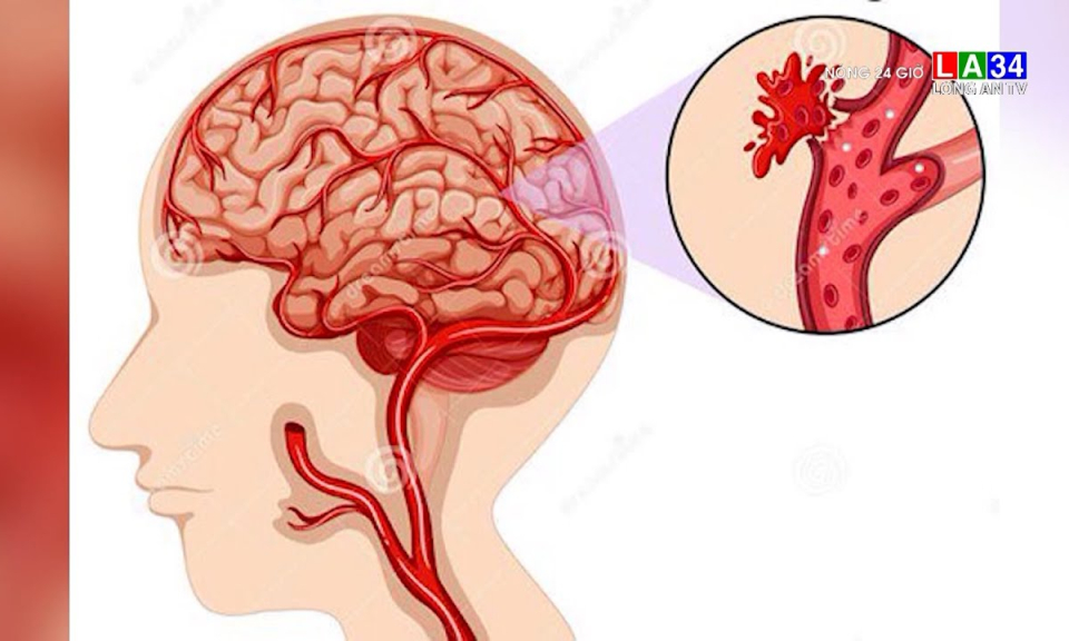 Lạm dụng dầu cá &#8211; Coi chừng rước họa