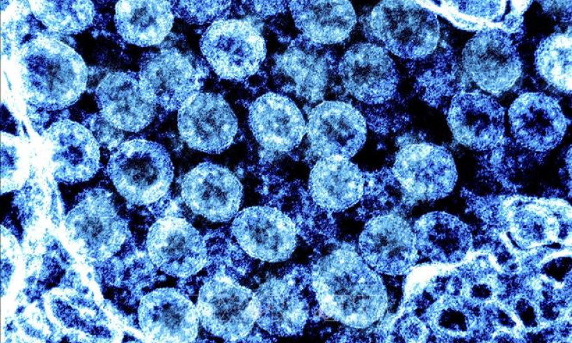 Người nhiễm biến thể Delta có thể lây lan virus 2 ngày trước khi có triệu chứng