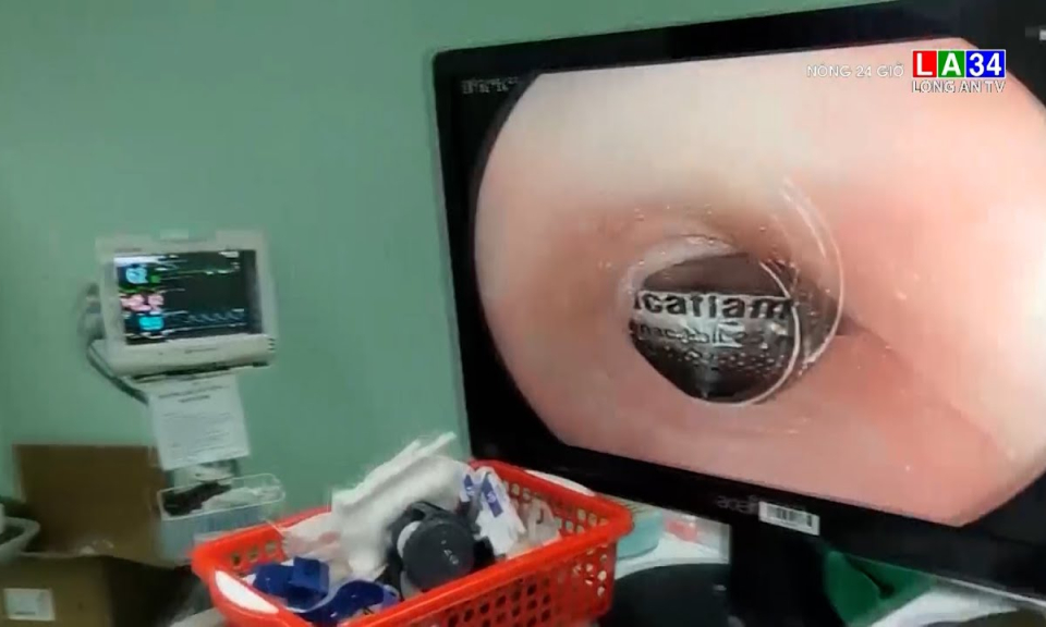 Nghẹt thở xem bác sĩ ở Cần Thơ cứu bệnh nhân bị hóc viên thuốc nguyên vỏ