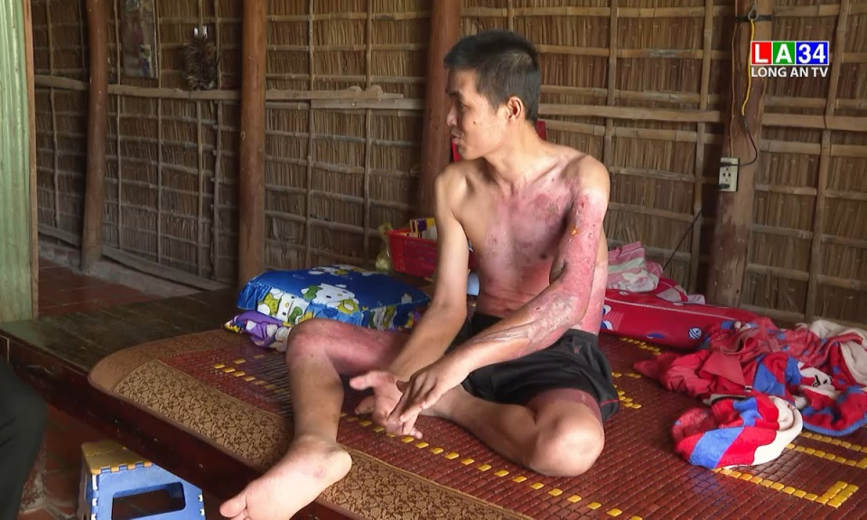 Vượt qua hiểm nghèo: Hoàn cảnh anh Võ Thanh Vũ - Huyện Vĩnh Hưng - Tỉnh Long An