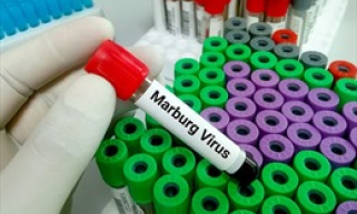 Nâng cao cảnh giác với bệnh do virus Marburg​