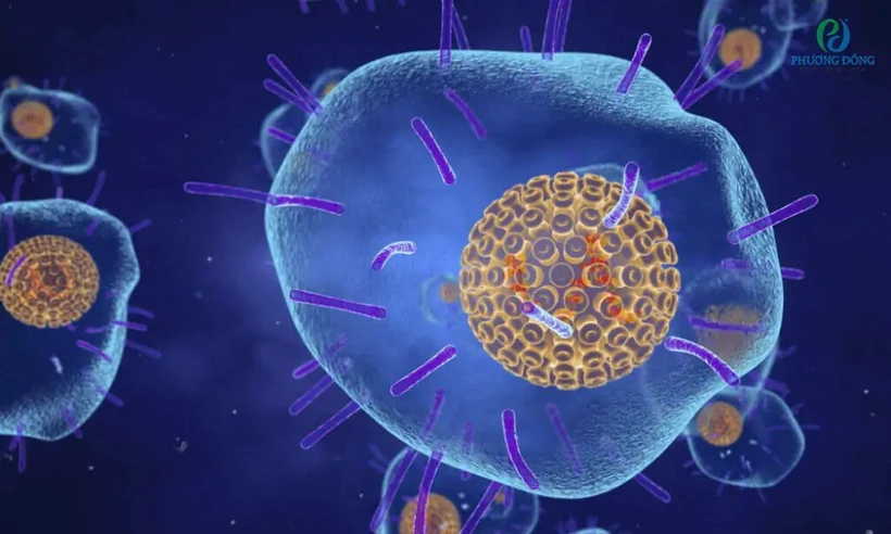 Virus thủy đậu còn được gọi là Varicella Zoster virus là tác nhân gây ra bệnh zona thần kinh