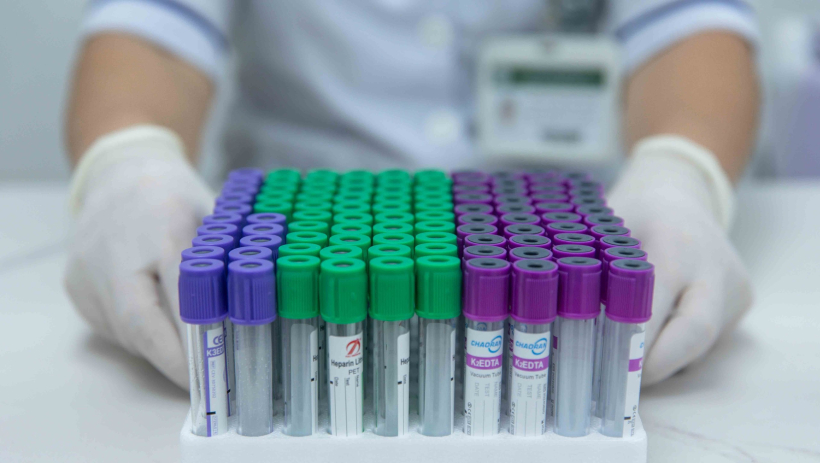 Từ 2027 quỹ BHYT sẽ chi trả s&agrave;ng lọc sớm một số bệnh